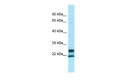 YRDC Rabbit anti-Human, Polyclonal, Novus Biologicals 0.1 mL | Buy Online | Novus Biologicals | Fisher Scientific
